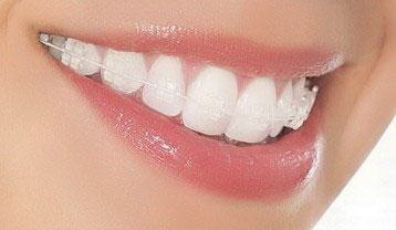 牙齿和咬肌有关系吗_牙齿护理的正确方法