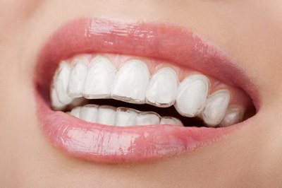 牙齿损伤怎么修复最好_牙齿损伤怎么修复好得快