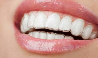 钛合金的牙齿(钛合金牙齿——打破传统牙齿修复方法)