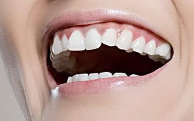 植牙一般多长时间_广州好的种植牙齿医院