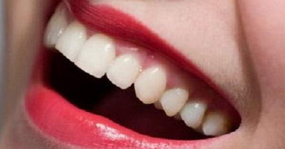 一般洗牙都会牙周上药吗(洗牙时是否一定要牙周上药？)