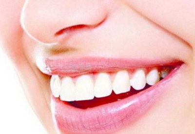 牙齿楔状缺损 补牙_补牙的问题