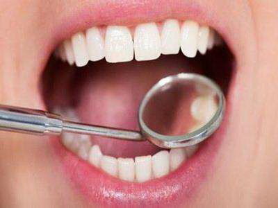 洗牙可以洗掉牙齿黑点吗(洗牙能否洗掉牙齿黑点？)