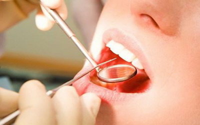 牙齿修复体是什么_牙齿修复最好方法