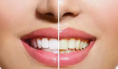 镶牙疼吗对于牙齿缺失有什么危害？