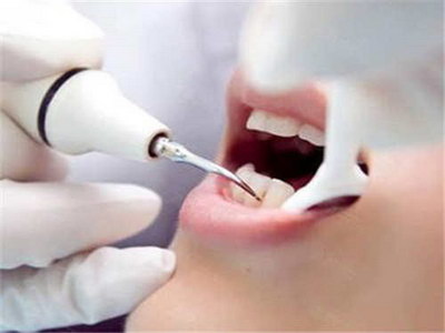 牙齿种植术要多久_牙齿种植注意什么