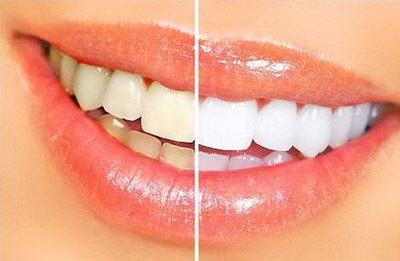 牙龈带着牙疼怎么办_牙和牙龈疼的厉害应该怎么办