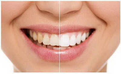 最后一排牙齿是什么牙齿_牙齿前排牙往前突