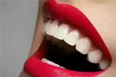 洗牙有年龄限制么_洗牙可以变白牙齿吗
