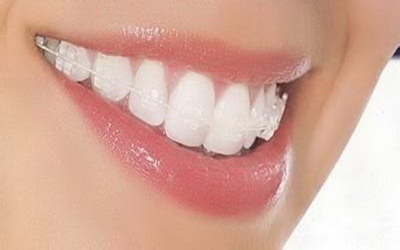 什么叫根管治疗牙齿(什么叫根管治疗牙齿痛吗)