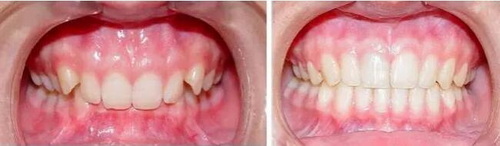 太原牙科医院排行榜出炉哪家牙科比较好？看这里