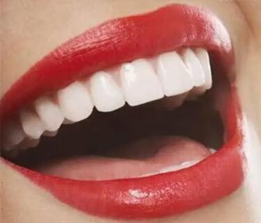 拔牙装假牙注意事项_拔牙后多久能装假牙