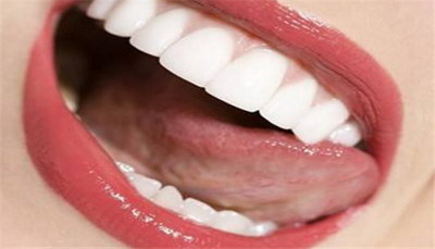 牙齿做牙套后牙套能用多久(牙套的使用时间)