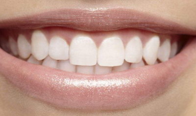 换牙后的牙齿黄黄的怎么办_牙齿黄怎么变白呢