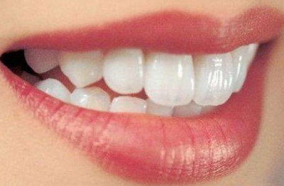 牙龈炎的用什么_牙龈炎治疗步骤