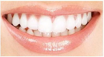 牙齿稀疏的矫正方式是什么呢？
