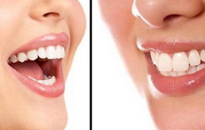 补牙后牙齿敏感医生说换材料