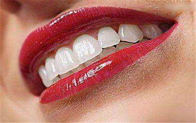 牙齿整形手术需要多久_牙齿整形手术的过程