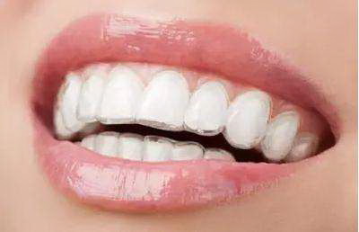 关于牙齿的治疗有哪些_刚刷完牙就有牙齿敏感