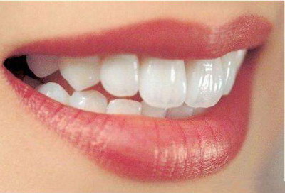 牙齿矫正需要多久?