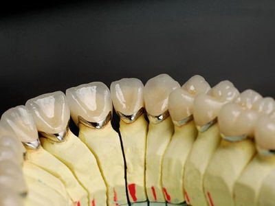 牙龈松动能恢复吗_牙龈和牙齿处发黑