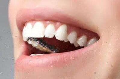 整牙会导致以后牙松动吗_拔牙后牙齿有缝隙怎么办