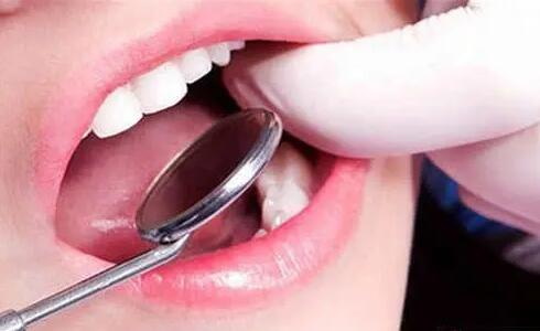 拔牙后吃什么消炎药比较好_拔牙矫正牙齿有什么后遗症