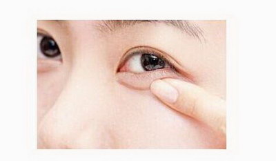 眼皮变成三层：新的美容技术带给你新的选择_为何双眼皮的父母却生了一个单眼皮的孩子？