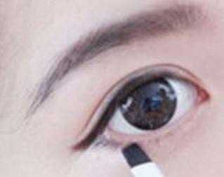 眼部除皱用什么方法最好_眼部除皱剥离术的副作用