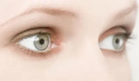 双眼皮手术后变黄几天能变肤色(埋线双眼皮手术后几天可以碰水)