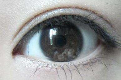 眼部带状疱疹有什么症状(眼部带状疱疹的症状概述)
