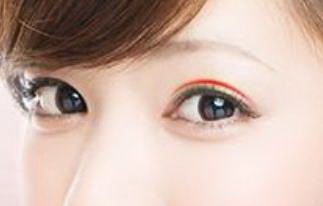 内吸眼袋后的恢复：一份关于眼球美容的指南_做完眼袋眼睛红怎么办
