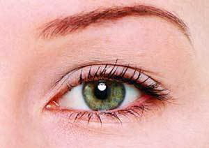 双眼皮手术后疤痕严重增生的原因_双眼皮手术后疤痕增生会消掉吗