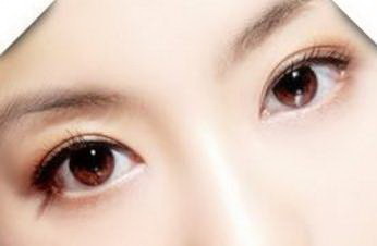 适合做韩式双眼皮手术的人有哪些？