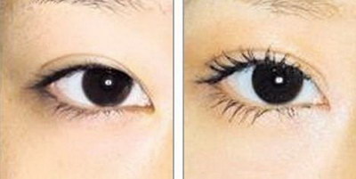 男性长期黑眼圈小心五种疾病