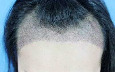 怎样使头发变黑变密_杭州有哪里要梳头发