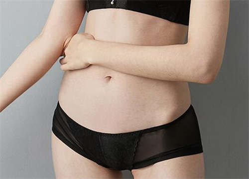 腹壁祛妊娠纹注意事项
